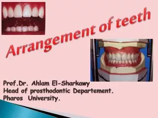 Arrangement of teeth