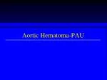 Aortic Hematoma-PAU