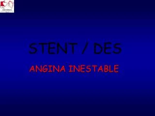 stent des