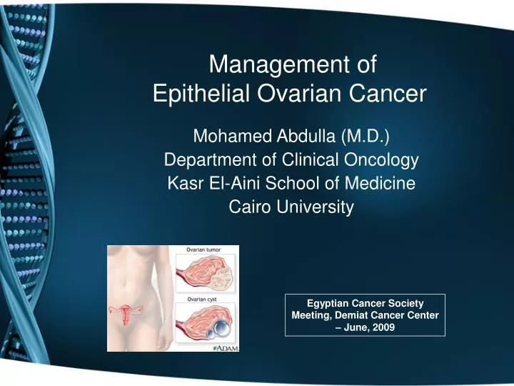 management of epithelial ovarian cancer
