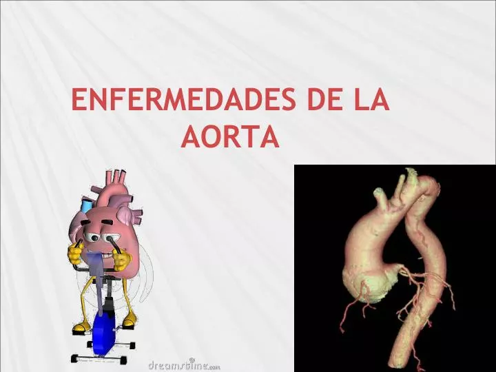 enfermedades de la aorta