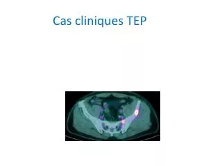 cas cliniques tep