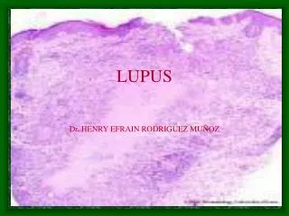 lupus