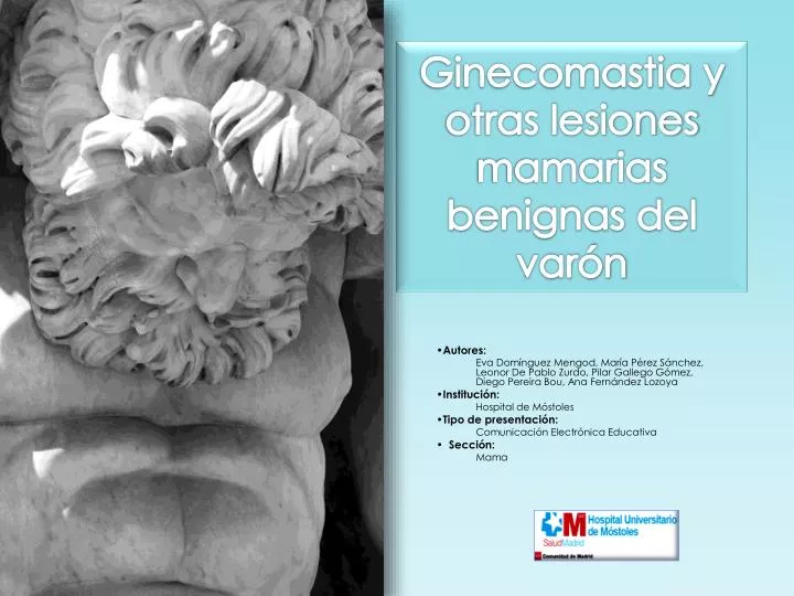 ginecomastia y otras lesiones mamarias benignas del var n