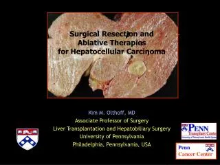 Surgical Resection and Ablative Therapies for Hepatocellular Carcinoma