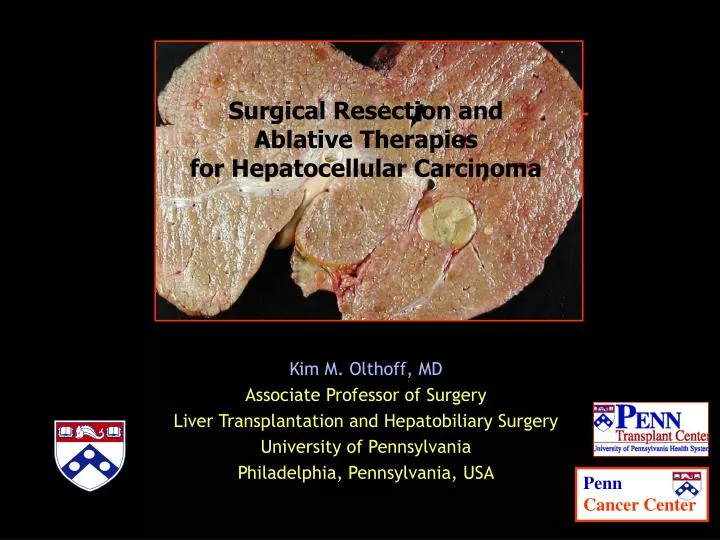surgical resection and ablative therapies for hepatocellular carcinoma