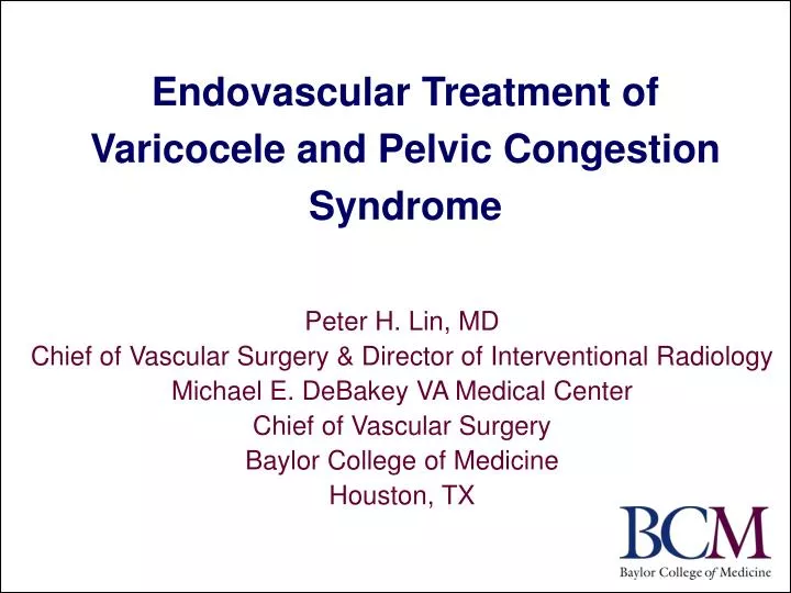 endovascular treatment of varicocele and pelvic congestion syndrome