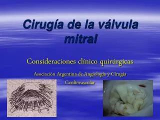 cirug a de la v lvula mitral