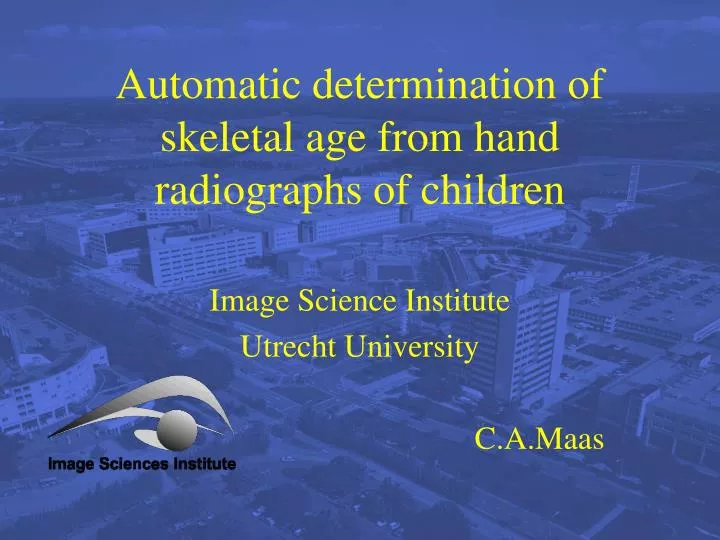 automatic determination of skeletal age from hand radiographs of children