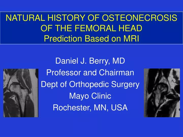 natural history of osteonecrosis of the femoral head prediction based on mri
