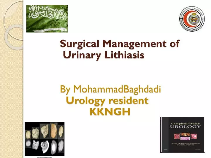 surgical management of urinary lithiasis by mohammadbaghdadi urology resident kkngh