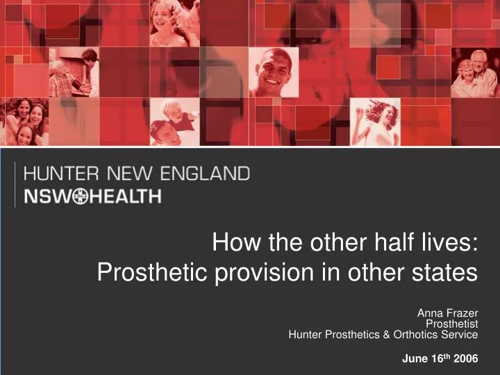 how the other half lives prosthetic provision in other states
