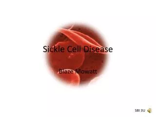 Sickle Cell Disease