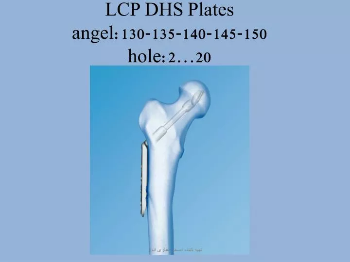 lcp dhs plates angel 130 135 140 145 150 hole 2 20