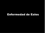 Enfermedad de Eales - slide 1
