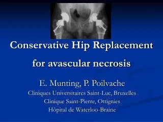 Conservative Hip Replacement for avascular necrosis