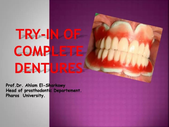 try in of complete dentures
