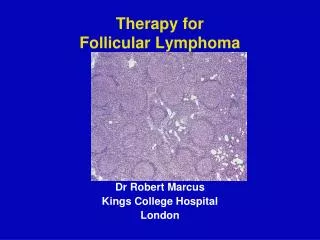Therapy for Follicular Lymphoma