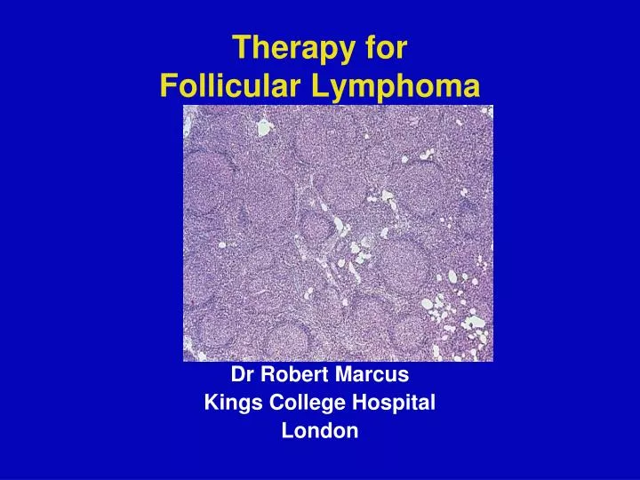 therapy for follicular lymphoma