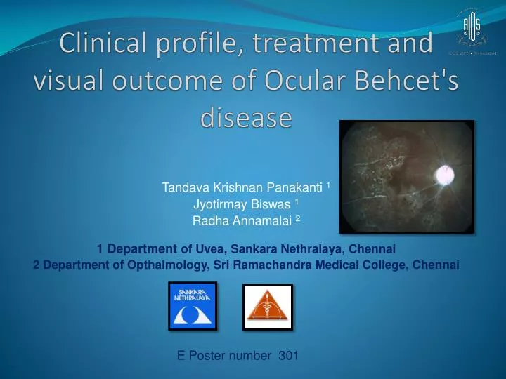 clinical profile treatment and visual outcome of ocular behcet s disease