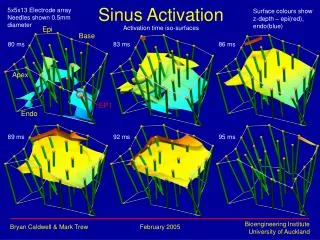Sinus Activation
