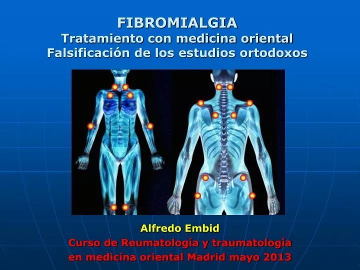 fibromialgia tratamiento con medicina oriental falsificaci n de los estudios ortodoxos