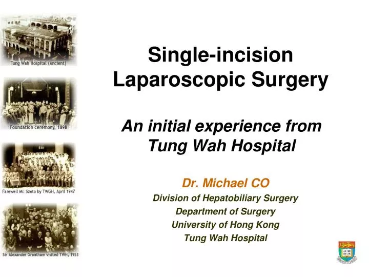 single incision laparoscopic surgery an initial experience from tung wah hospital
