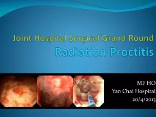 Joint Hospital Surgical Grand Round Radiation Proctitis