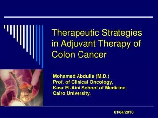 Therapeutic Strategies in Adjuvant Therapy of Colon Cancer