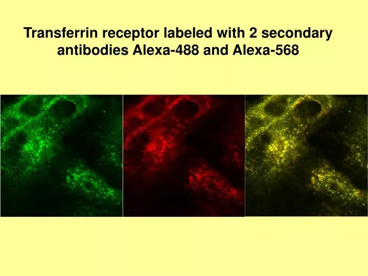 transferrin receptor labeled with 2 secondary antibodies alexa 488 and alexa 568
