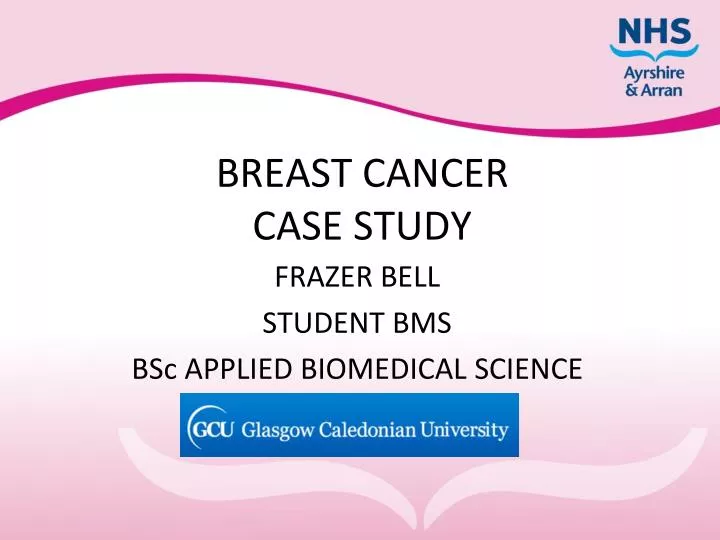 case study breast cancer ppt