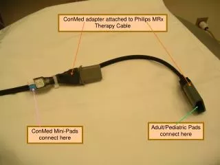 ConMed adapter attached to Philips MRx Therapy Cable