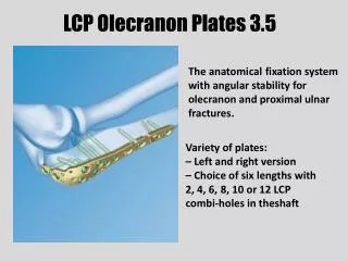 LCP Olecranon Plates 3.5