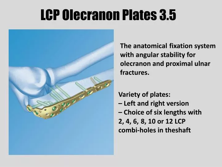 lcp olecranon plates 3 5