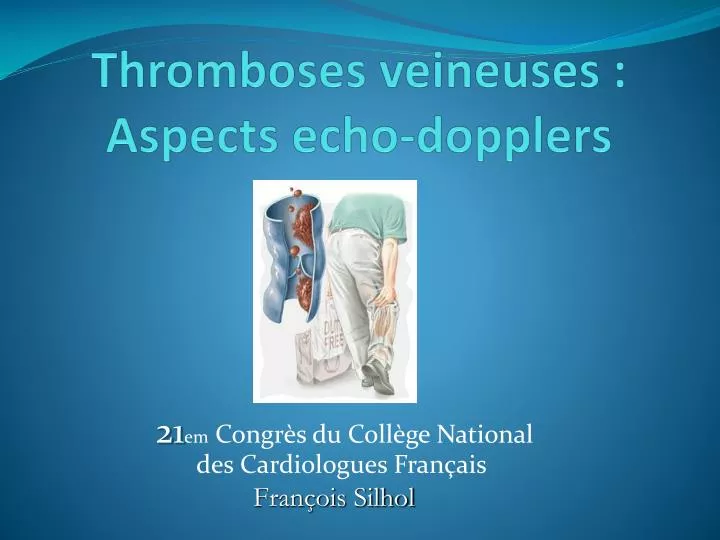 thromboses veineuses aspects echo dopplers