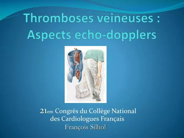 thromboses veineuses aspects echo dopplers