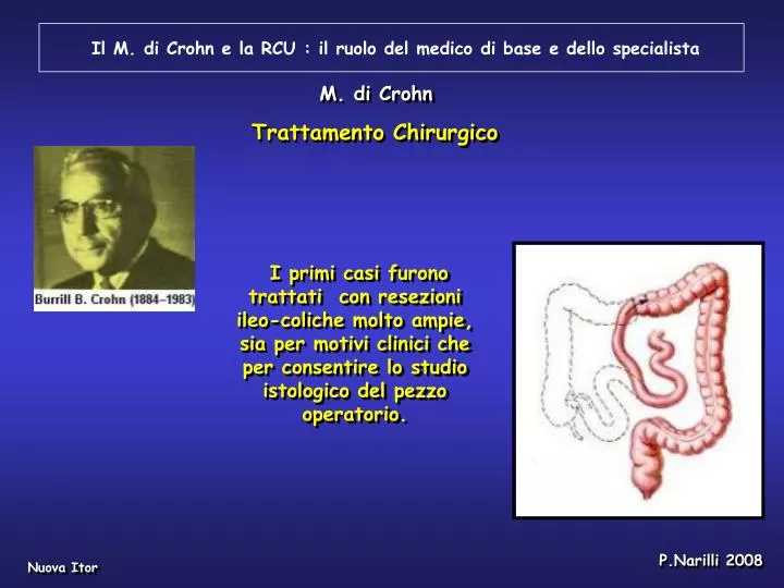 il m di crohn e la rcu il ruolo del medico di base e dello specialista