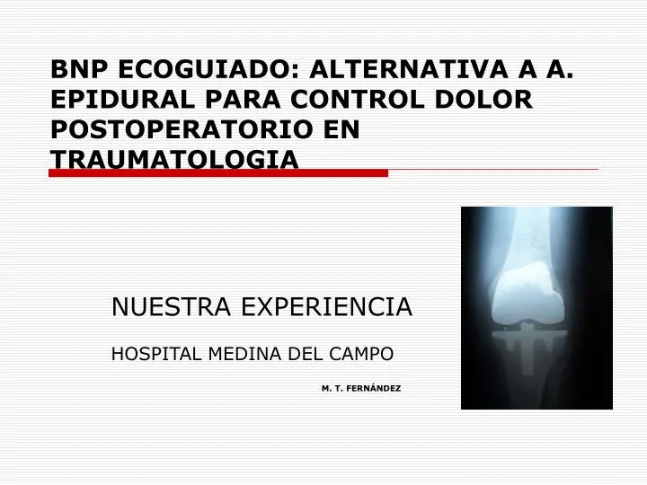 bnp ecoguiado alternativa a a epidural para control dolor postoperatorio en traumatologia