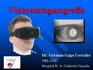 videonistagmograf a