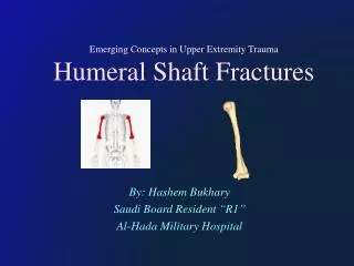 Emerging Concepts in Upper Extremity Trauma Humeral Shaft Fractures
