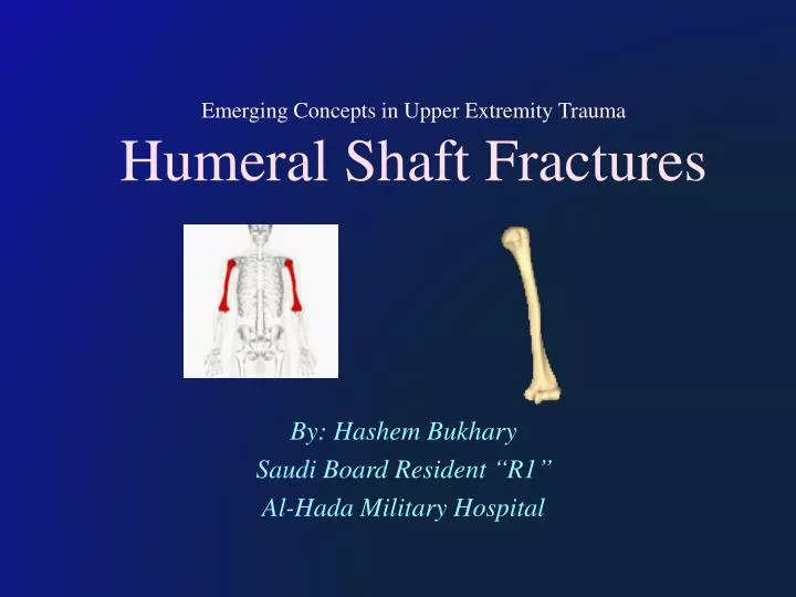emerging concepts in upper extremity trauma humeral shaft fractures
