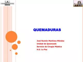 quemaduras