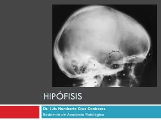 hip fisis