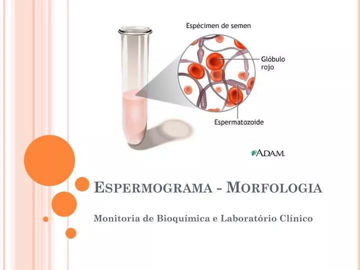 espermograma morfologia