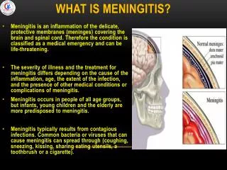 What is Meningitis?