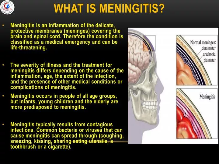 what is meningitis
