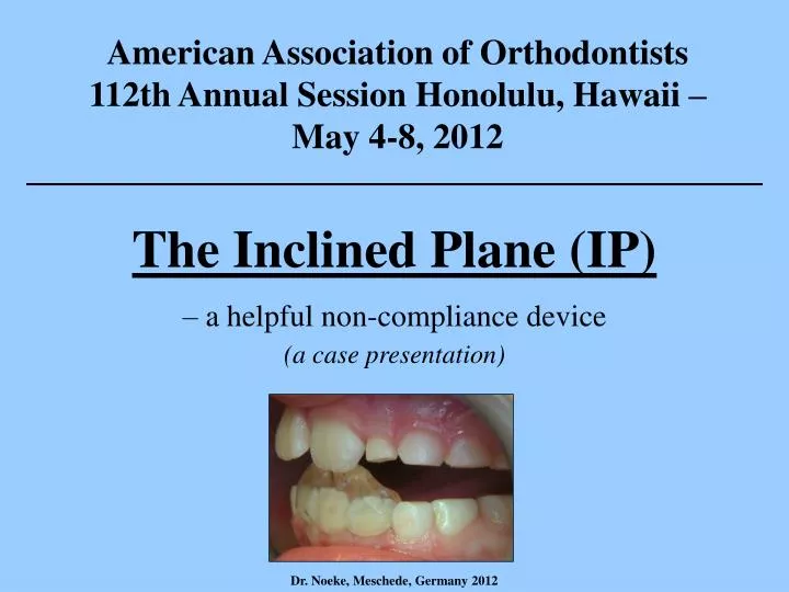 the inclined plane ip a helpful non compliance device a case presentation