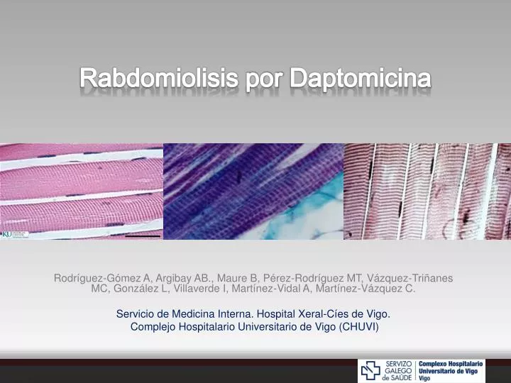 rabdomiolisis por daptomicina