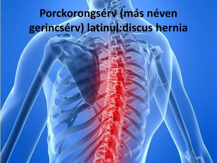 porckorongs rv m s n ven gerincs rv latinul discus hernia