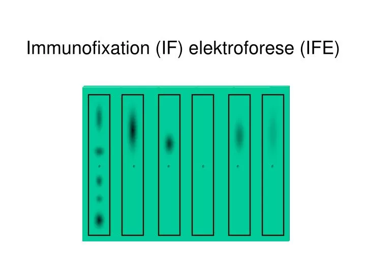 immunofixation if elektroforese ife